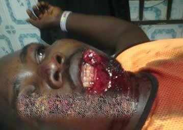 man off bites woman cut lip bite reporter naijapals gistmania delta lower graphic another state over dot problem please email