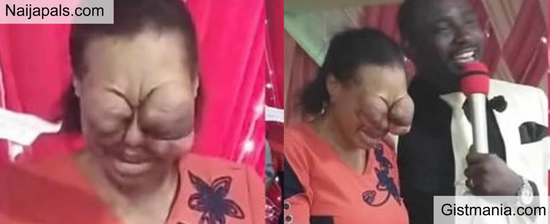 Shock As Lady Allegedly Damages Sister’s Eye Out of Jealousy Because of Man