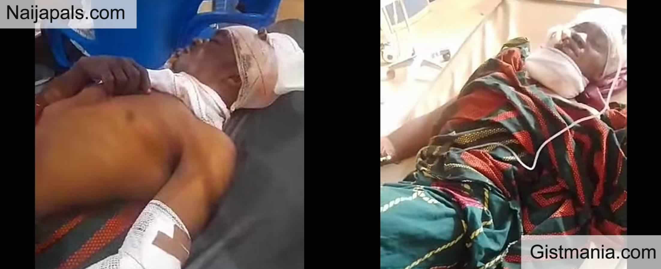 VID/PICS; Suspected Herdsmen Kill Three Farmers, Injure Others In Enugu Community