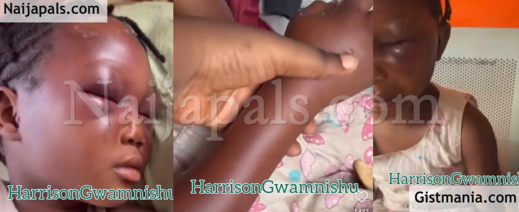 PHOTOS: 8 Years Old Girl Severely Assaulted and Left Almost Blinded by Her Aunt in Lagos