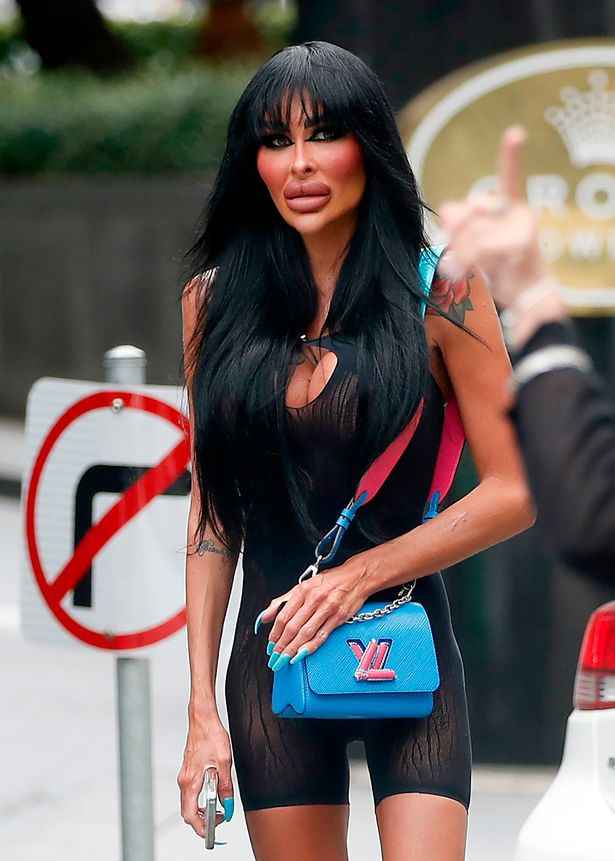 Syd taktik Gøre en indsats Human Barbie Doll, Tara Shows Of New Plastic Surgery After Spending The  Whooping Sum Of £110,00 - Gistmania
