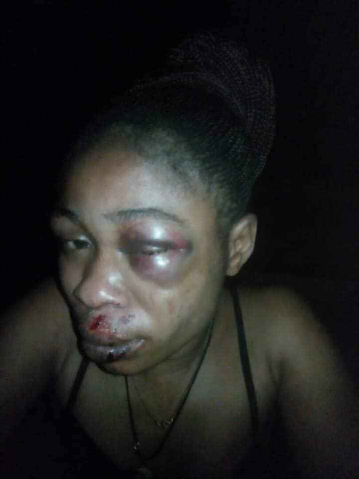 Photos: 3-Month-Old Pregnant Woman Beaten Blue And Black By ...