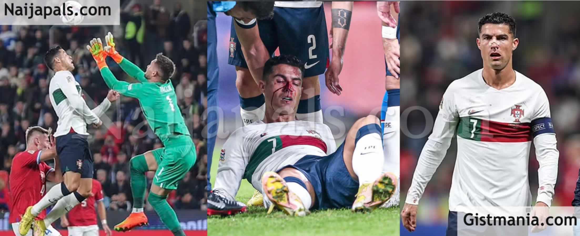 man-utd-star-cristiano-ronaldo-suffers-horror-injury-in-portugal-s-thrashing-of-czech-republic