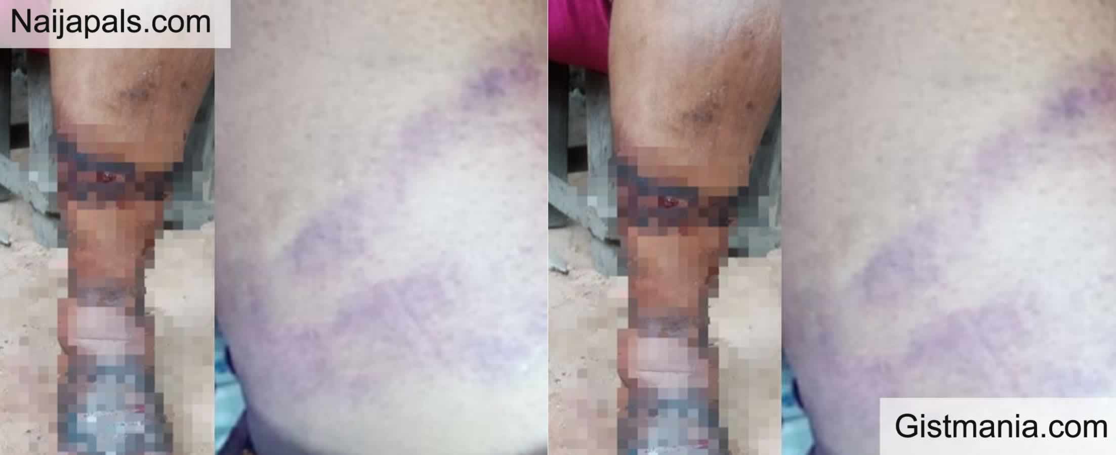 Nursing Mother Disfigured After She Was Allegedly Brutalized By Special Anti Touting Squad