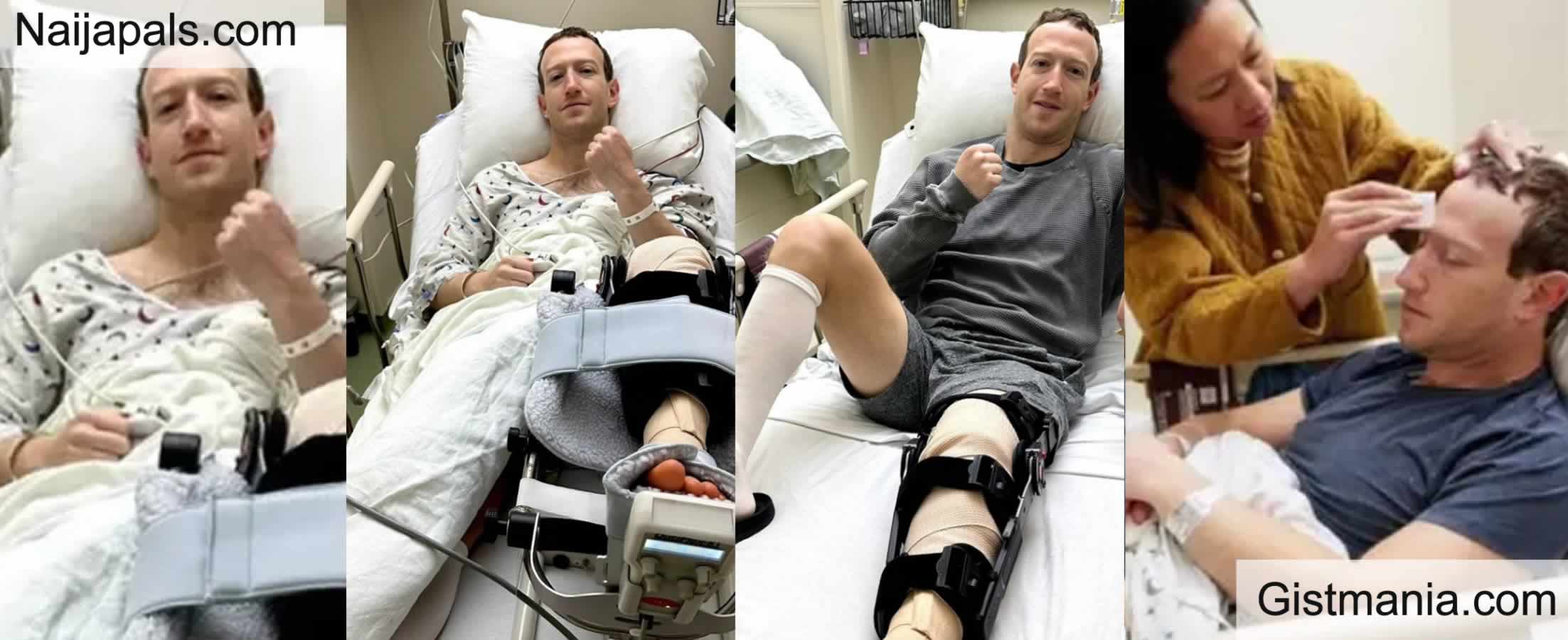 Mark Zuckerberg Undergoes Surgery For Knee Injury, Shares Pics On Instagram